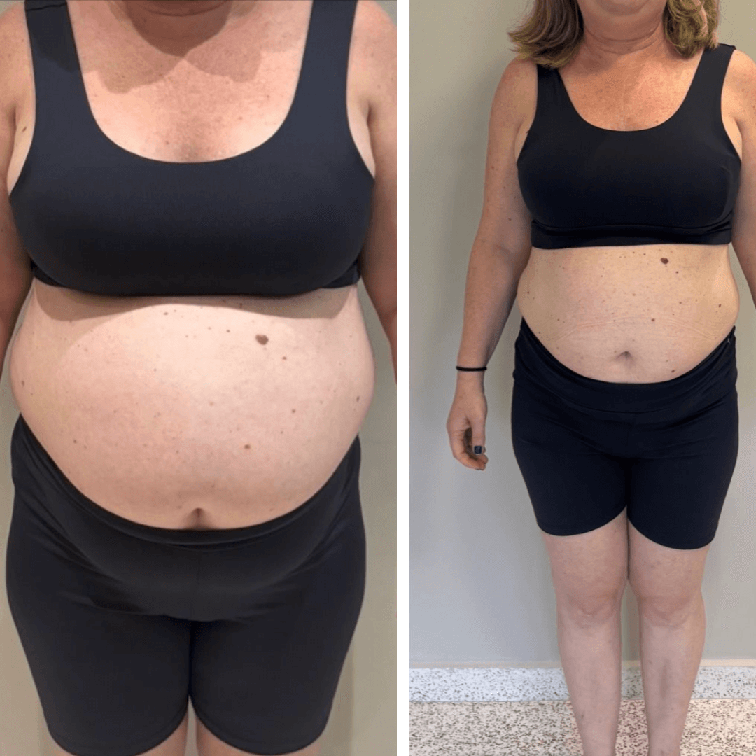 Resultado de transformação 4